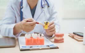 虫歯の進行度別の治療法を説明する歯科医師