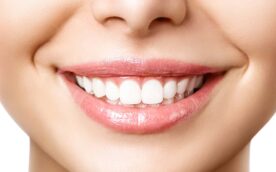審美歯科治療で美しくなった歯のイメージ