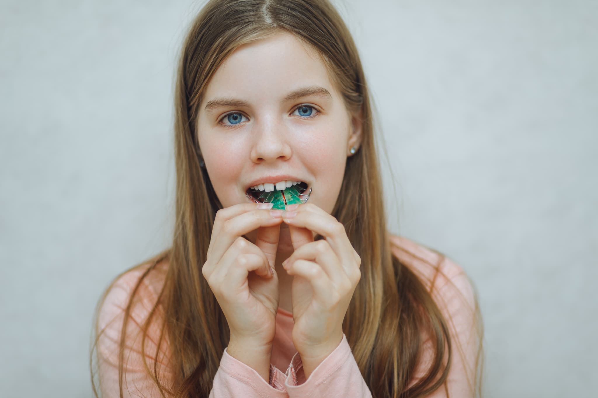 床矯正で歯列を整える子ども