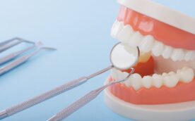 歯の模型とデンタルミラーなど