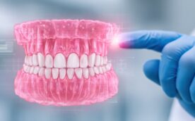 歯周病予防のための歯茎の健康について説明する歯科医師