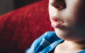 口呼吸をする子どもの口もと