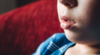 口呼吸をする子どもの口もと