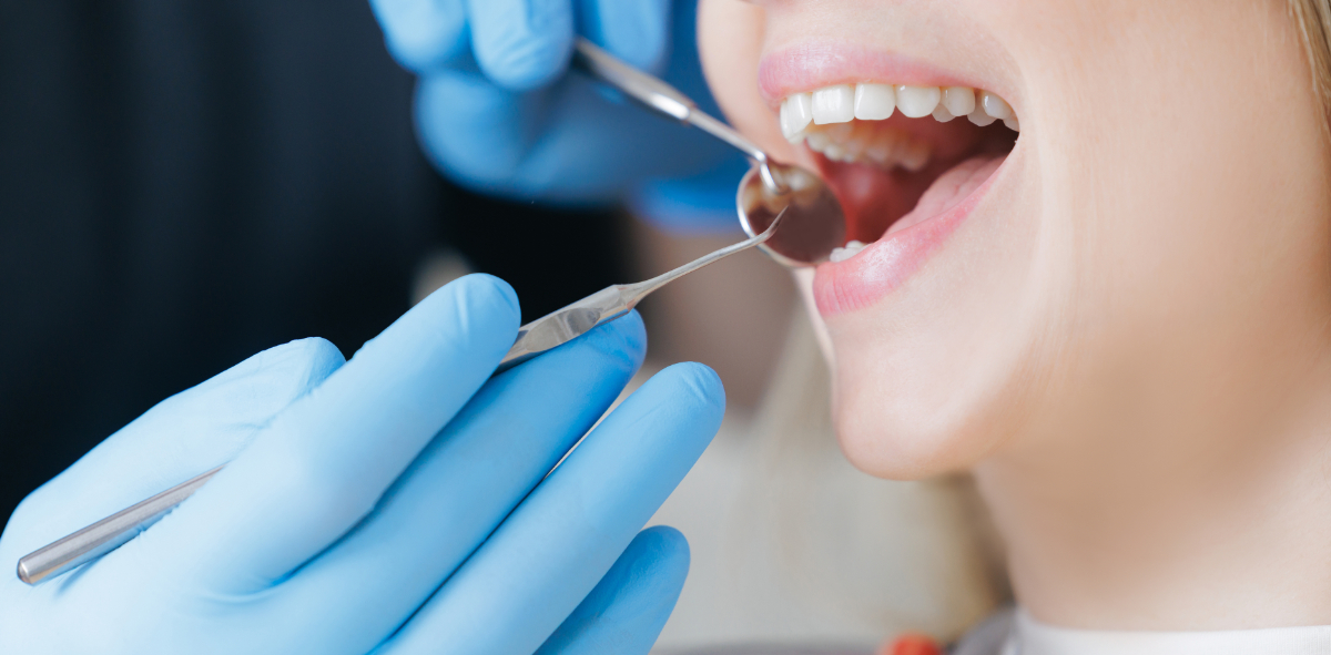 前歯の虫歯を治療している