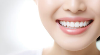 セラミックの歯