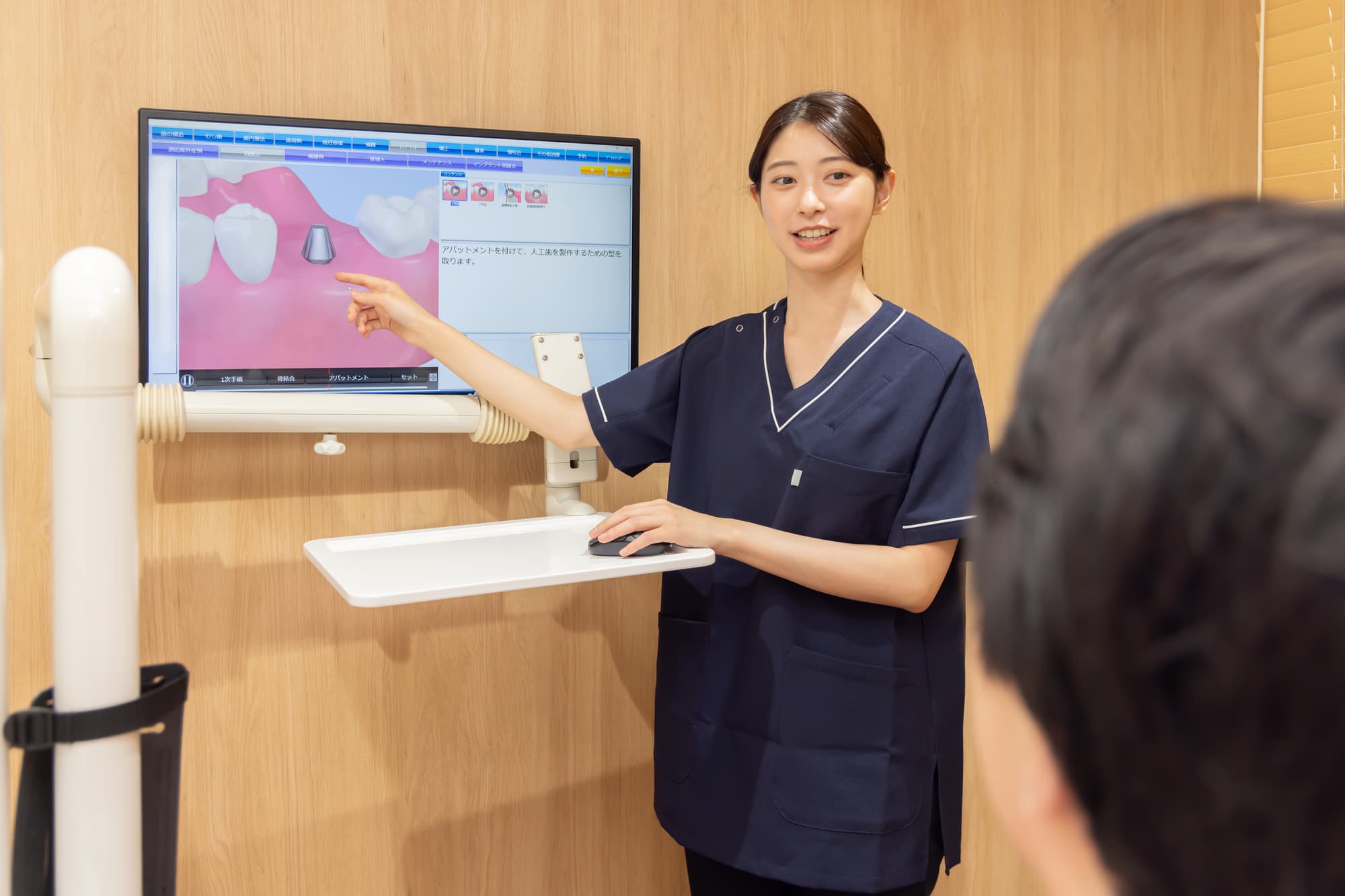 インプラント治療後に歯茎が黒くなる原因についてモニターで説明する歯科医